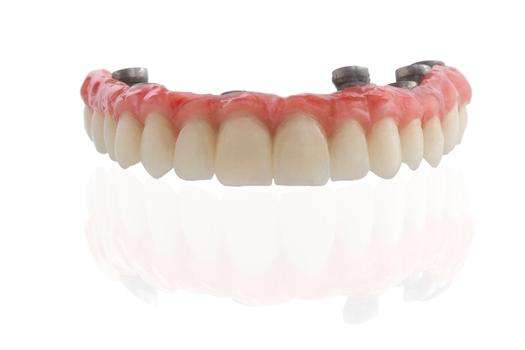 protesis-dental-completa-clinica-dental-SMALIUM-cerdanyola