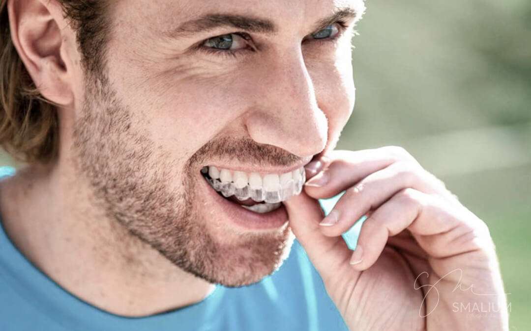 Por qué elegir Invisalign, la Ortodoncia Invisible?