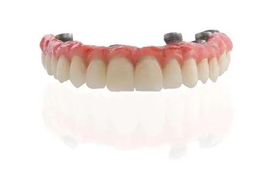 protesis-dental-completa-clinica-dental-SMALIUM-cerdanyola