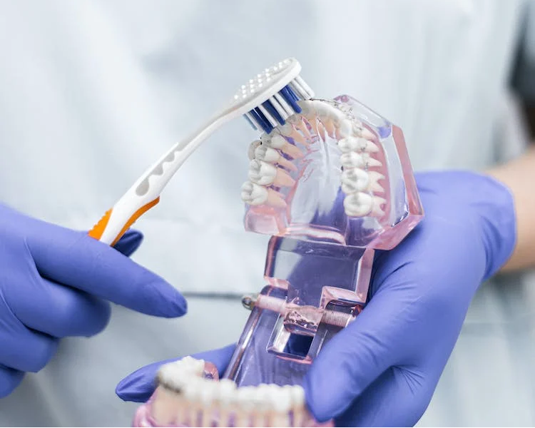 La higiene posterior a la colocación de Implantes Dentales
