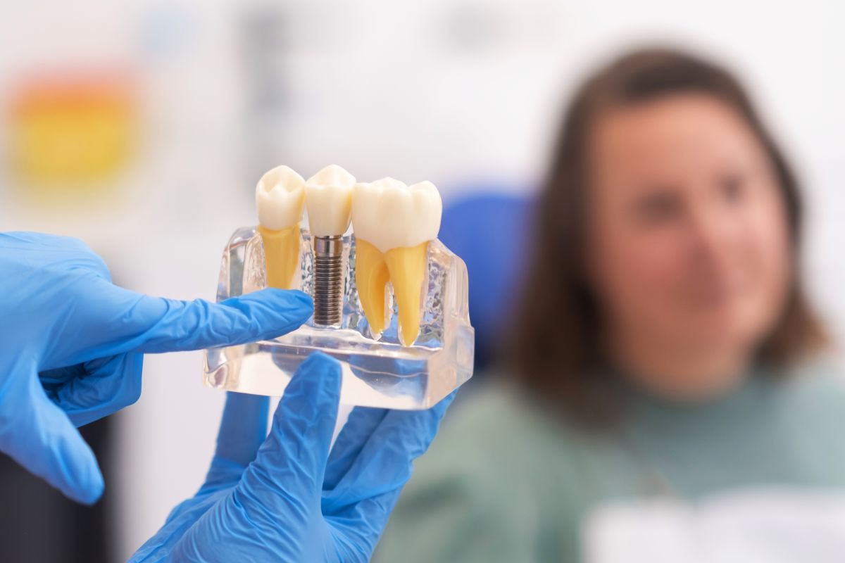Prevenir periimplantitis