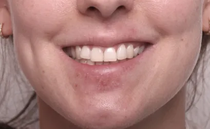 antes Isabella Ozgun